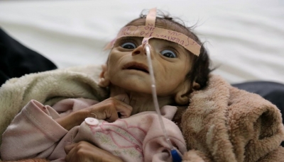 اليونيسف: اليمن أسوأ مكان فى وجه الأرض للأطفال وأكثر من 11 مليون طفل بحاجة للمساعدات