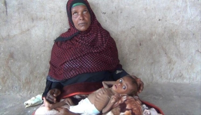 مسؤول أممي: أطفال يمنيون تتهددهم المجاعة في أحضان أمهاتهم العاجزات