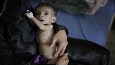 اليونيسف: خطر المجاعة يهدد 2٫4 مليون طفل في اليمن