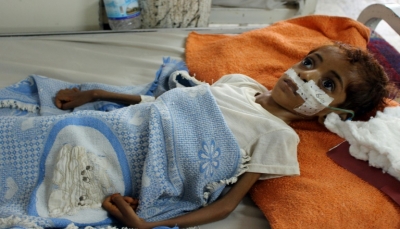أطباء اليمن في سباق مع الزمن لعلاج أطفال يعانون من سوء التغذية