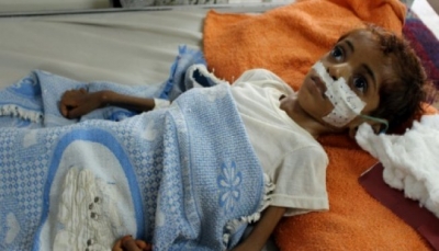 الأمم المتحدة: المجاعة في اليمن قد تطال 14 مليون شخص