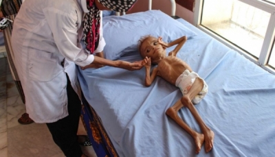 اليونيسيف: إنهاء الحرب ليس كافيا لإنقاذ الأطفال في اليمن