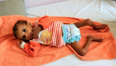 اليونيسف تصف اليمن بـ "جحيم حي" وتطالب بوقف الحرب
