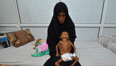 الصحة العالمية: علاج 15 ألف طفل يمني من سوء التغذية خلال 15 شهر