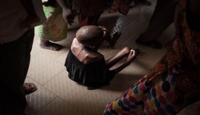 في تقريرها السنوي.. اليونيسف: طفل من ثلاثة بالعالم يعاني من سوء التغذية