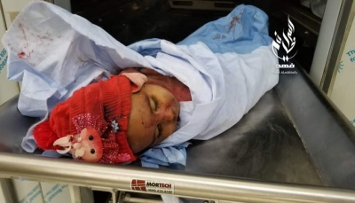 "أمر مروع".. اليونيسف: مقتل 11 طفلا خلال الثلاث الأيام الماضية باليمن