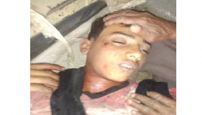 لحج: مقتل طفل برصاص قناص ميليشيات الحوثي غربي مديرية "القبيطة"