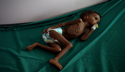 اليونيسف تحذر من انزلاق ملايين اليمنيين إلى المجاعة تأثراً بانهيار الاقتصاد