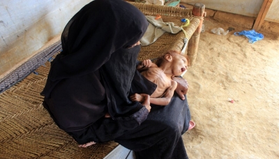 نيويورك تايمز: المجاعة تطارد اليمن مع استمرار الحرب وتراجع المساعدات الخارجية (ترجمة)