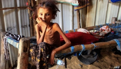 برنامج أممي يحذر من تصاعد انعدام الأمن الغذائي في اليمن