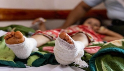 تقرير أممي: مقتل وإصابة أكثر من 11 ألف طفل خلال الحرب في اليمن