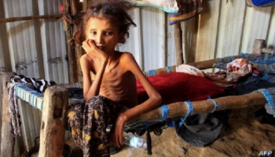 منظمة دولية: اليمن ثاني دول العالم تضرراً من انعدام الأمن الغذائي