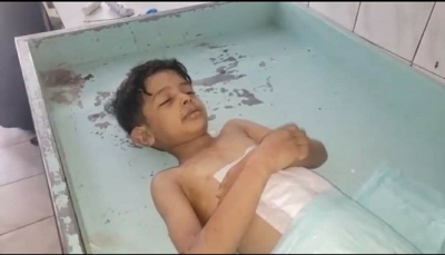 رابطة حقوقية: مقتل وإصابة أكثر من 14 ألف طفل في اليمن غالبيتهم جراء القصف الحوثي